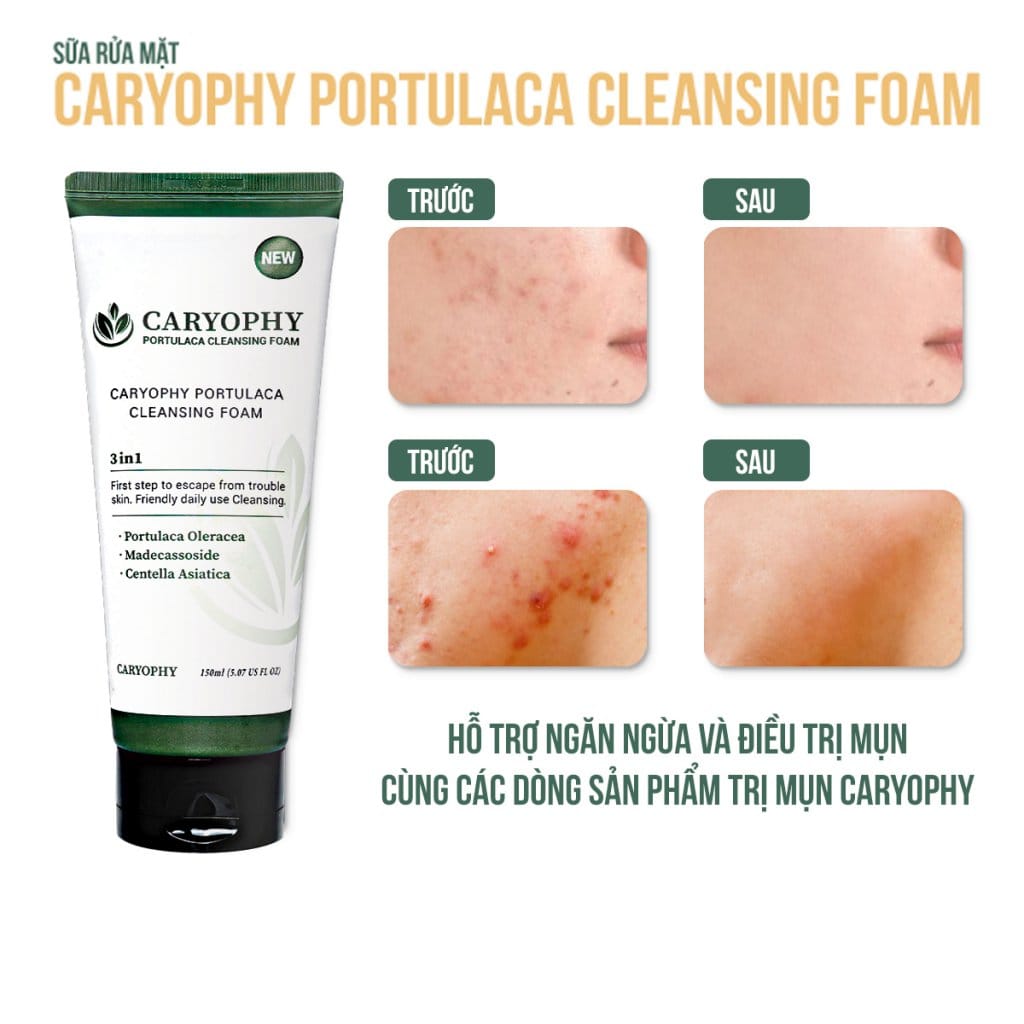 Sữa rửa mặt Caryophy Portulaca Cleansing Foam 150ml – NEW 4 Sữa rửa mặt Caryophy Portulaca Cleansing Foam 150ml – NEW